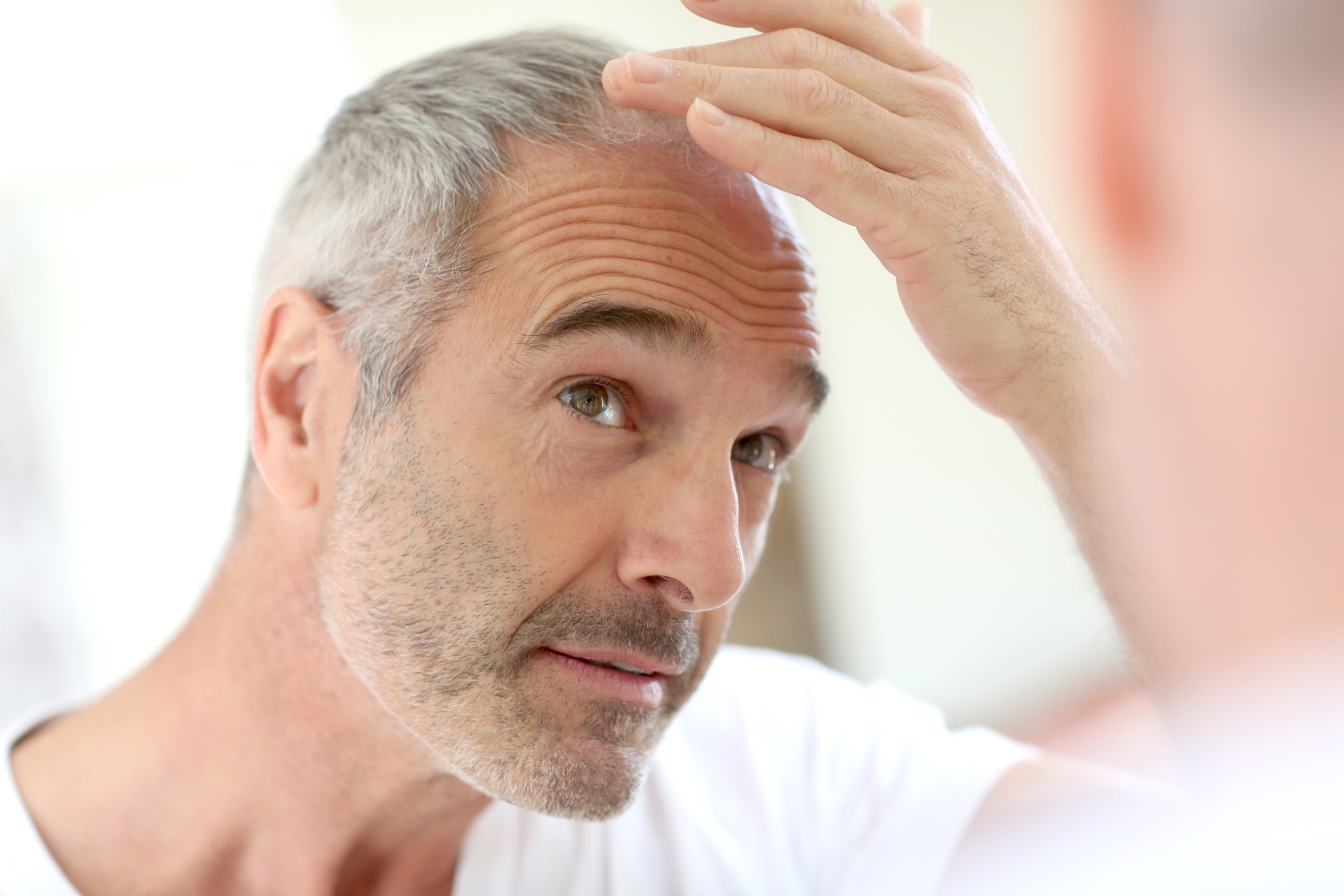 You are currently viewing What should I know about FUE hair transplantation?